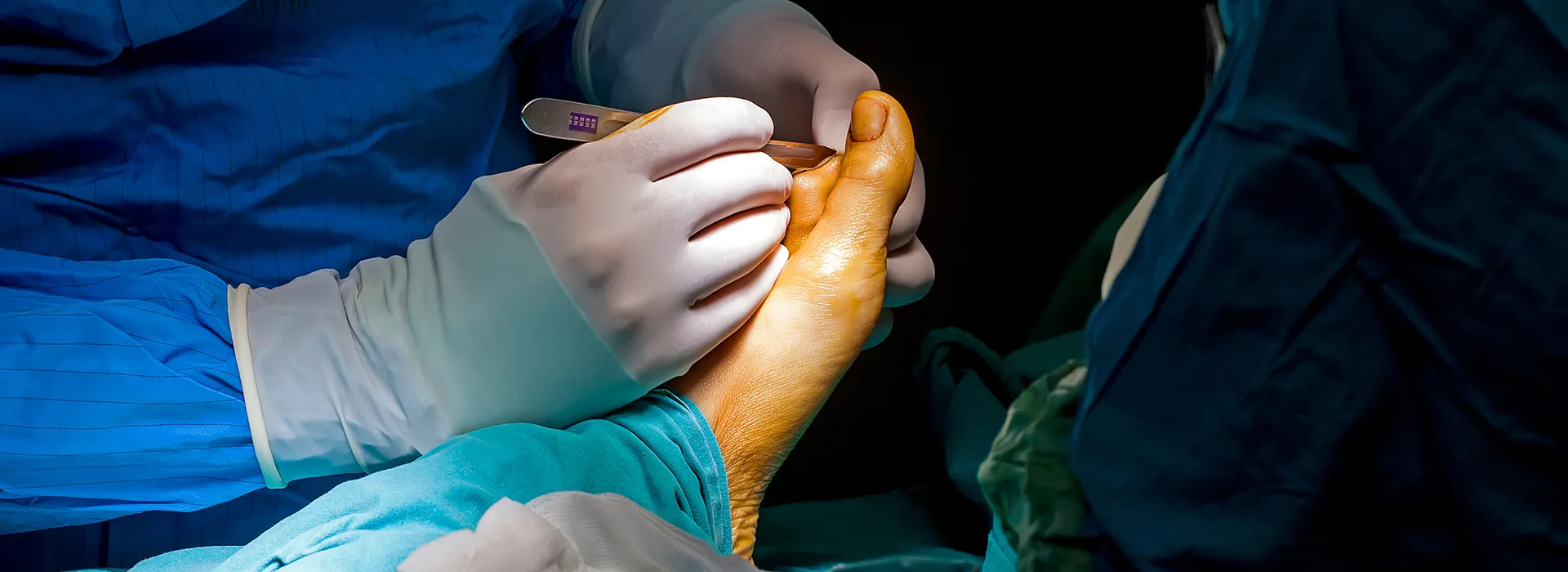 Programa de desarrollo profesional permanente en cirugía de pie y tobillo